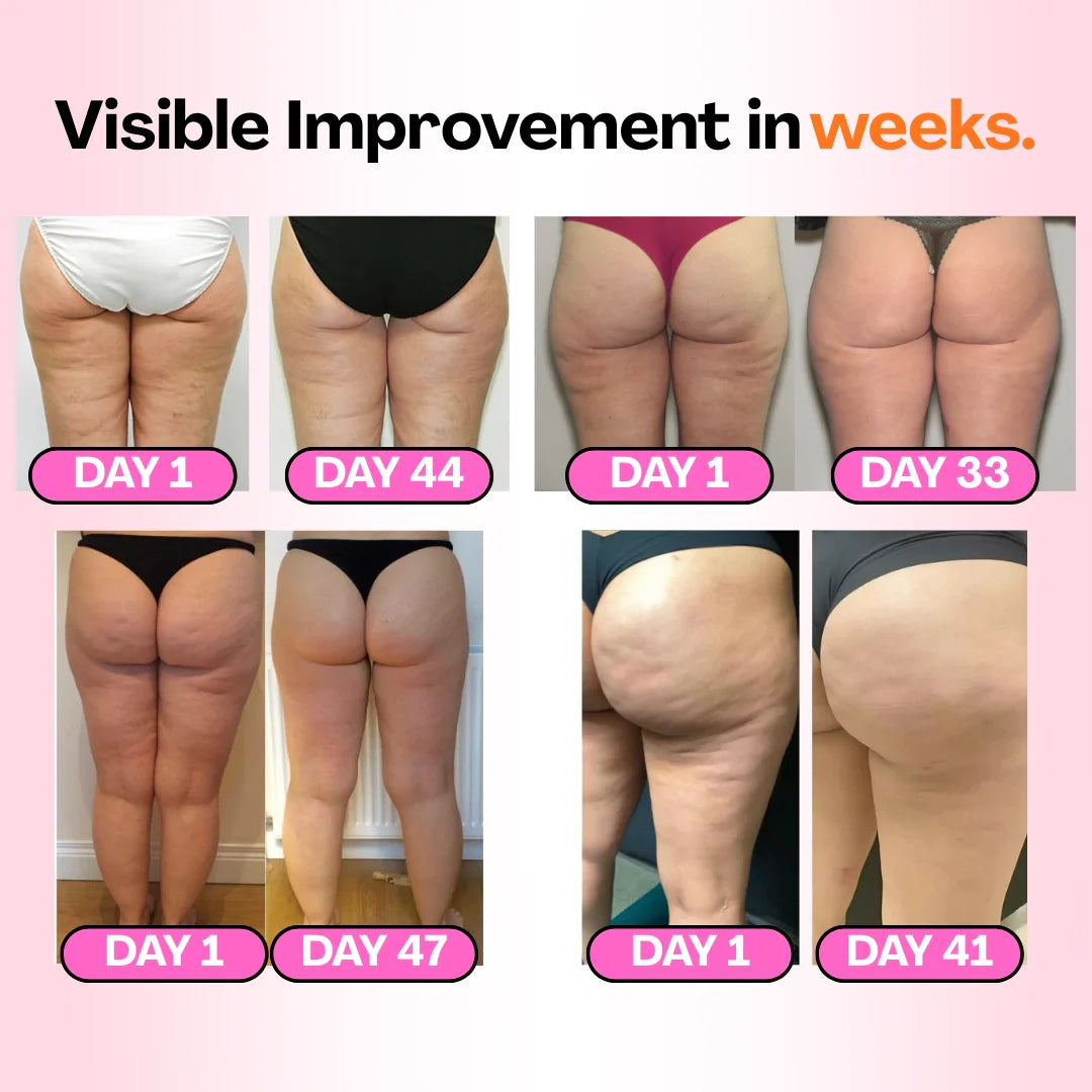 Anti-cellulite Tights - Redefine your silhouette effortlessly (3-Pack)