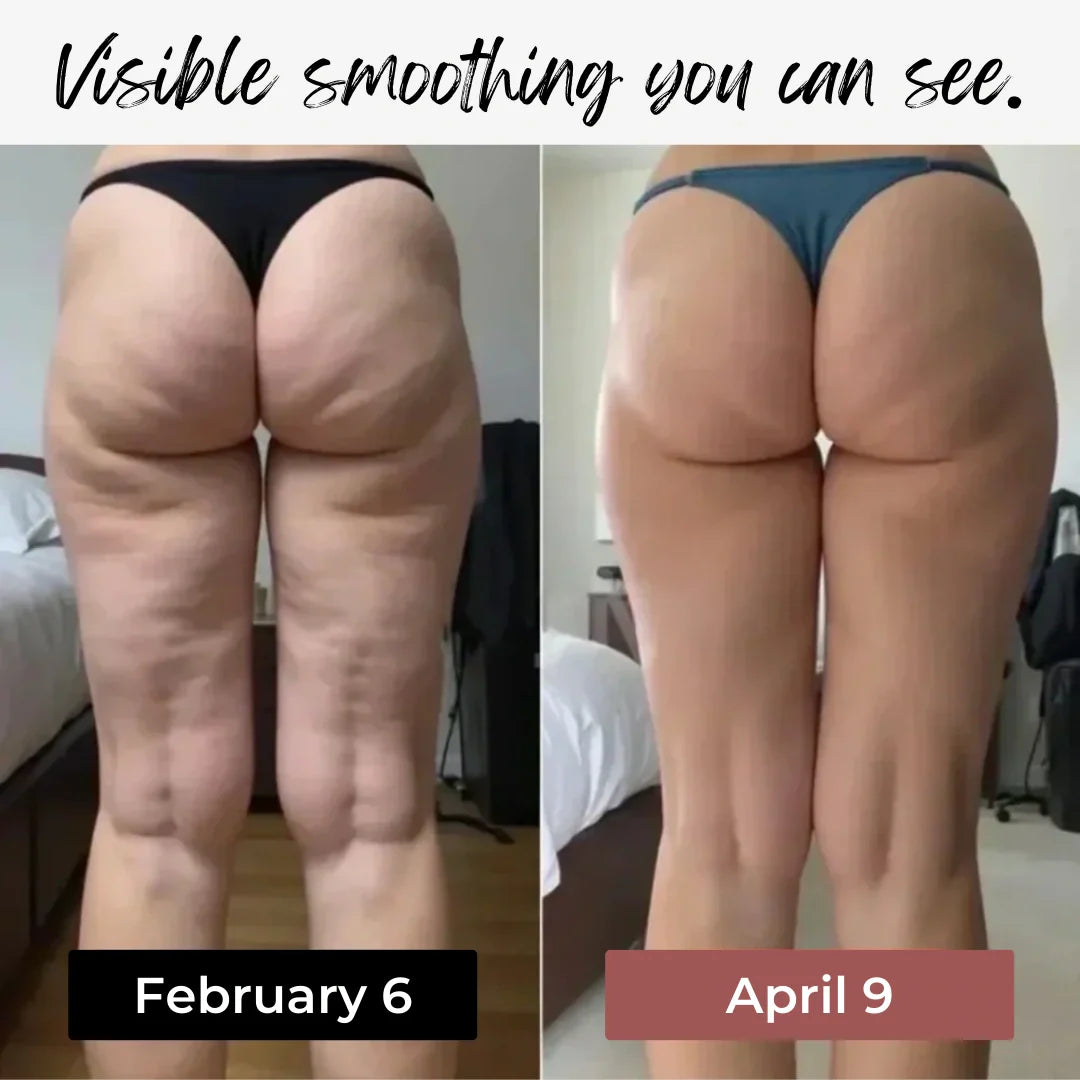 Anti-cellulite leggings designed to show visible smoothing in as little as 14 days