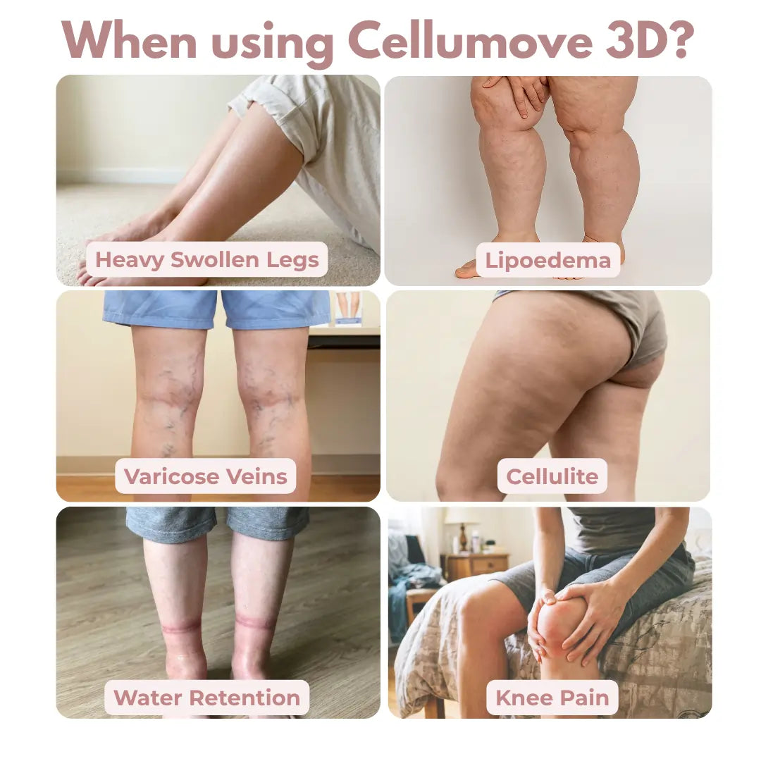Cellumove 3D Legging — Daily lymphatic drainage