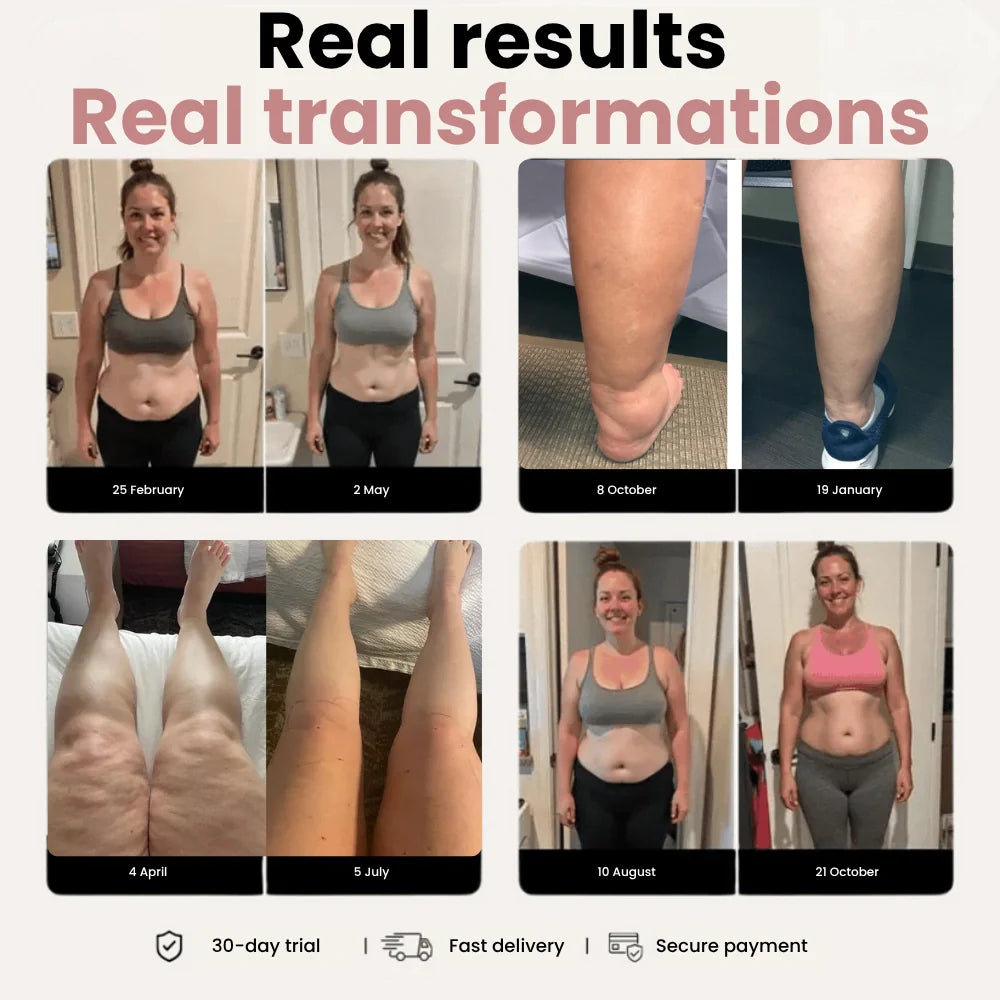 Cellumove 3D Legging – Designed to reduce post-partum swelling and restore comfort naturally